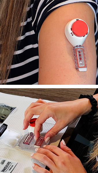 DBS on arm and sealing for shipping